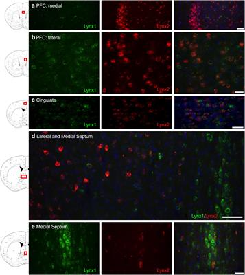 Differential Expression Patterns of Lynx Proteins and Involvement of Lynx1 in Prepulse Inhibition